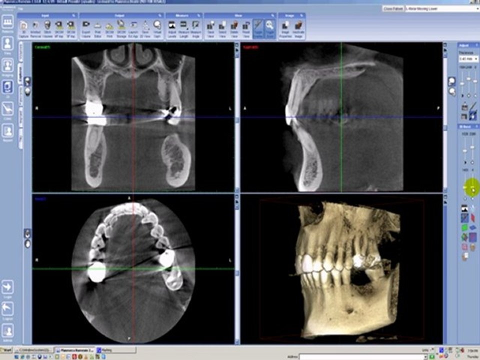 Visor 3D