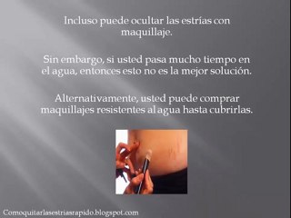 Como Eliminar Las Estrias Sin Cirugia