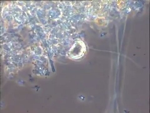 Examen comparatif des boues du grand pilote du SBR de la station d'Eppeville (Picardie), après ensemencement par une boue filamenteuse