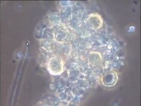 Microfaune de la boue de la sucrerie d'Eppeville (Picardie) âgée de deux jours, à fort grossissement