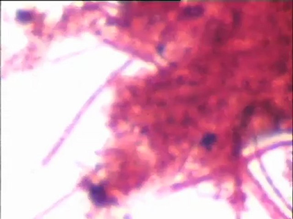 Examen en coloration Gram de deux échantillons : bactéries décrochées des biolites du pilote de dénitrification au saccharose de Colombes, et bactéries filamenteuses du grand pilote de la sucrerie d'Eppeville (Picardie)