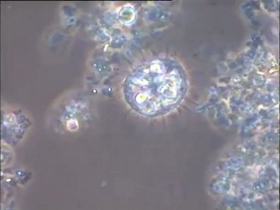 Examen des boues d’Irepolia : bassin de La Fremoire