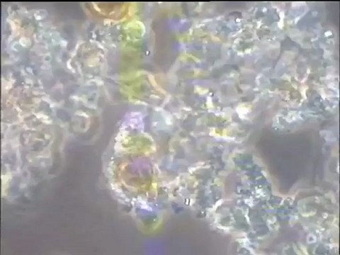 Examen de boues de Valladolid : observation de la microfaune au microscope