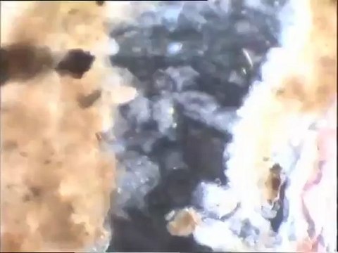 Observation des oligochètes dans les biomasses de Noisy-le-Grand