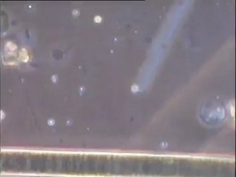 Examen des biomasses d'un étang envahi d'algues : observation d'un tardigrade et du reste de la microfaune au microscope