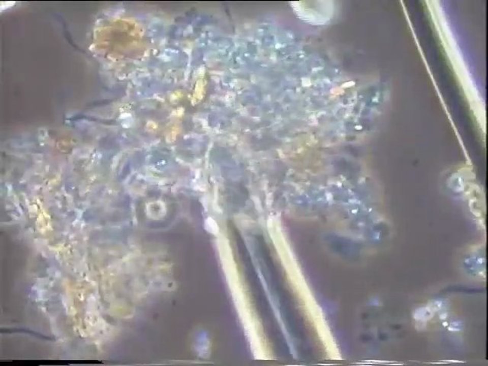 Examen des biomasses de boues activées de Malt Europe : expérience d'aération de deux flacons d'eau brute dont un mal aéré