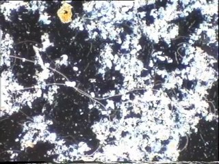 Examen au microscope des échantillons d'eau brute de Malt Europe ensemencés avec la boue activée de leur bassin tampon, et du témoin au 5ème jour de l'expérience