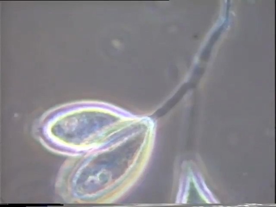 Examen au microscope des résultats d'ensemencement des eaux brutes de Malt Europe par la boue activée de leur bassin tampon, au 6e jour de l'expérience
