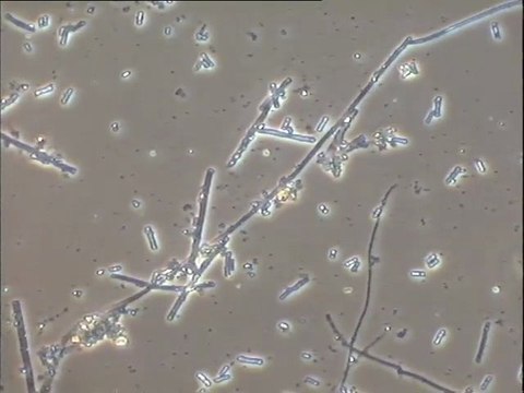 Examen d'une boue d'abattoirs (Brive) : détail des biomasses