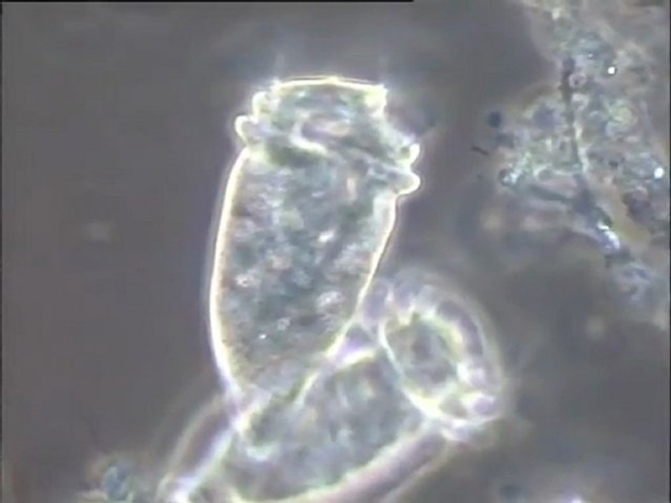 Examen au microscope d'une boue activée et de sa microfaune : détermination de son origine possible