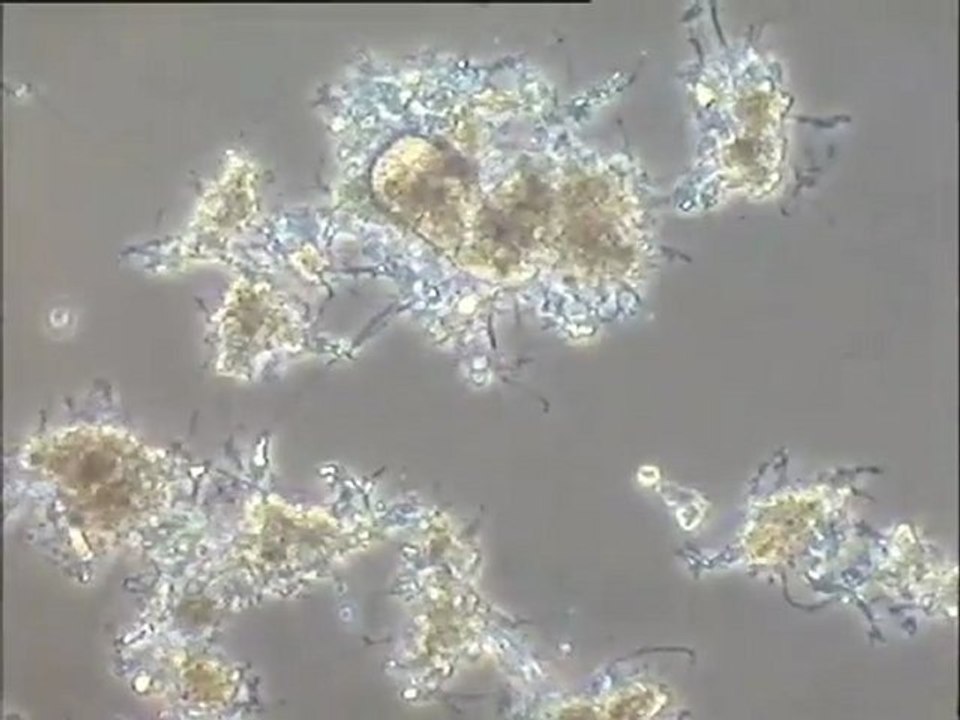 Examen des boues mousseuses du Carré de Réunion : détail des biomasses et des filaments (Nocardia)