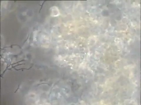 Examen d'une boue activée mousseuse du Carré de Réunion : détail des biomasses au microscope fort grossissement