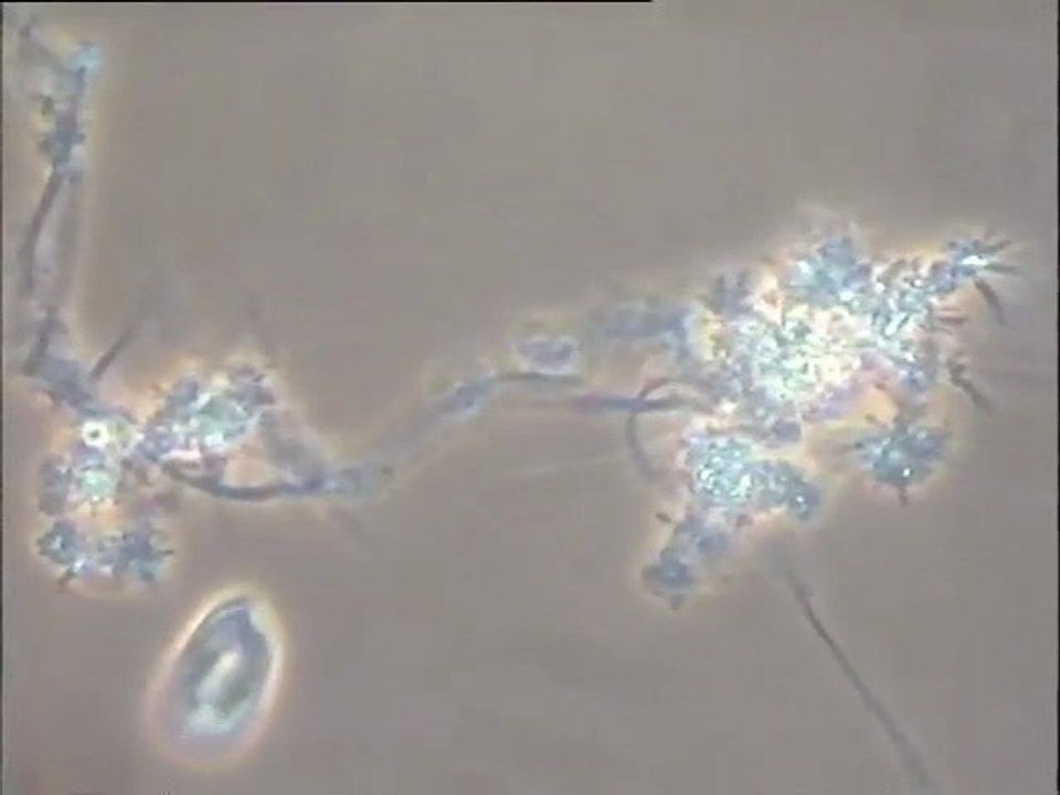 Examen des boues de la fromagerie Bel Sablé après traitement anti-mousse : évaluation du résultat, comparaison de deux filières dont une avec du chlore