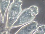 Examen des microfaunes des boues d’Achères : 1er bassin (bonne qualité) et bassin combiné (présence de filaments)