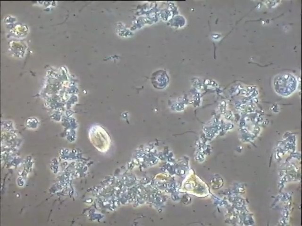 Examen des biomasses des flottants et du surnageant du clarificateur de la station du Carré de Réunion