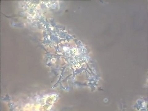 Examen de boues activées d'une station d'Amiens contaminées par des bactéries filamenteuses : observation du filtrat, de la boue activée, et de plusieurs échantillons de mousses