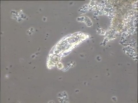 Observation d'une population de rotifères sur un boue mise en aération avec du talc : prédation d'un rotifère sur un zoïde de péritriche