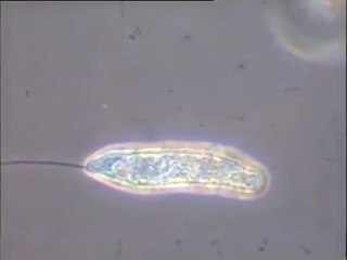 Observation d'une boue âgée riche en zooflagellé