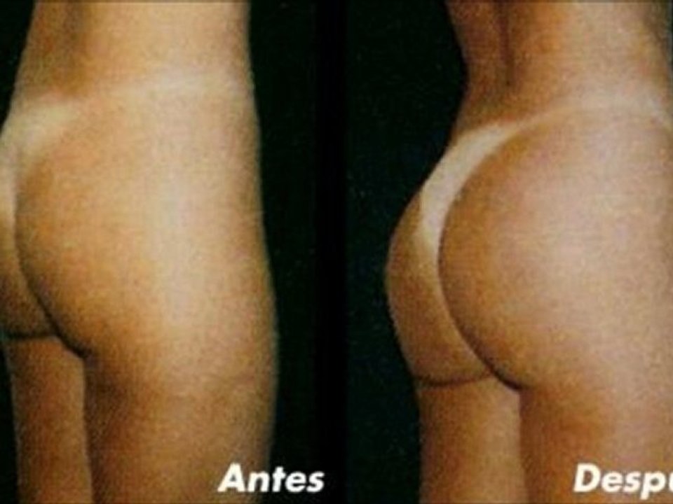 cirugia nariz costo