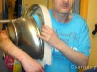 Il termine aux urgences le bras dans...