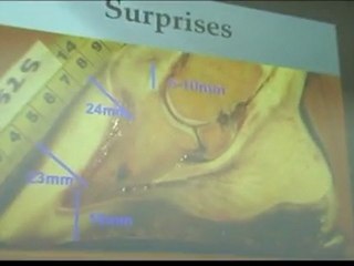 Brian Hampson - 1/2 - Forschung an Wildpferdehufen (feral horse foot research) - Huftagung der DHG 2011 Leipzig - Deutsche Huforthopädische Gesellschaft e.V.