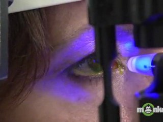 Macular Degeneration Diagnosis