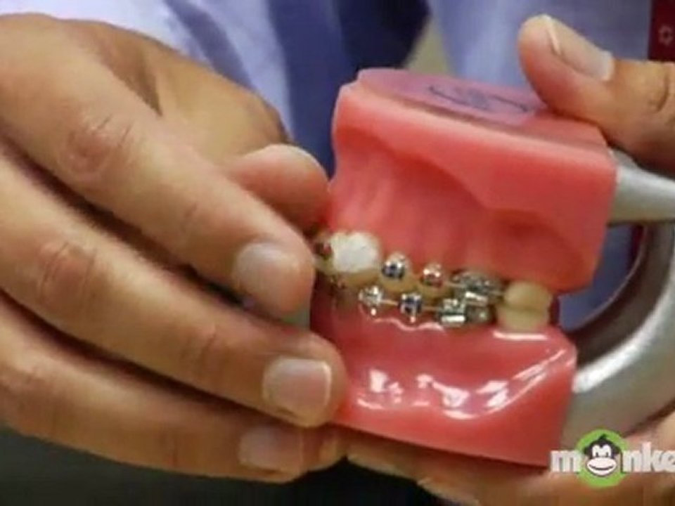 Cleaning Braces-Proxy Brush & Dental Wax