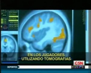 Cerebro y recompensa (Dopamina): Luke Clark