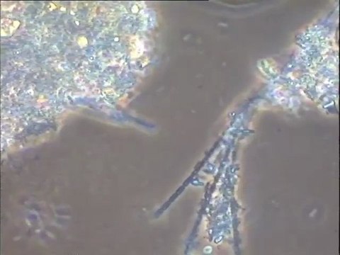 Examen des matières en suspension dans l'eau brute et l'eau de sortie des décanteurs du densadeg de l'usine de Colombes, et des boues du densadeg, après un traitement au chlorure ferrique (FeCl3)