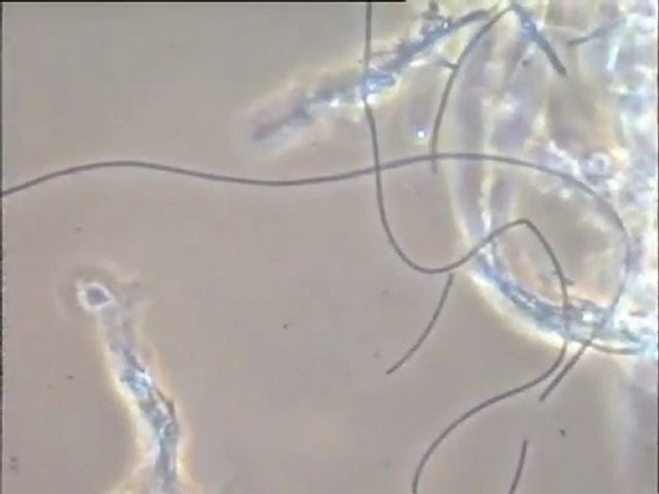 Examen d'une boue activée de  la fromagerie Bel de Sablé-sur-Sarthe (Sarthe)