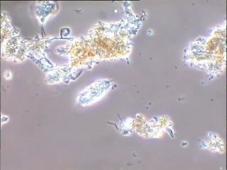 Faune microscopique du sessile de Noisy-le-Grand : ciliés, acinétiens