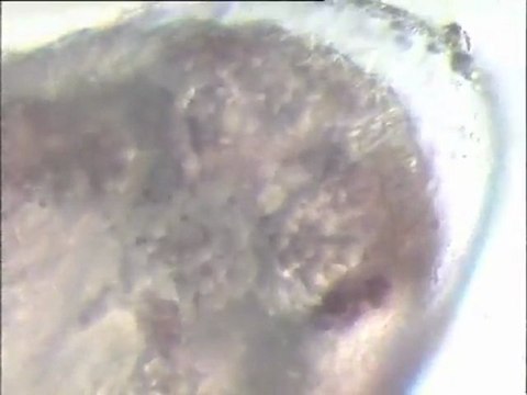 Examen de cochenilles parasites à la binoculaire