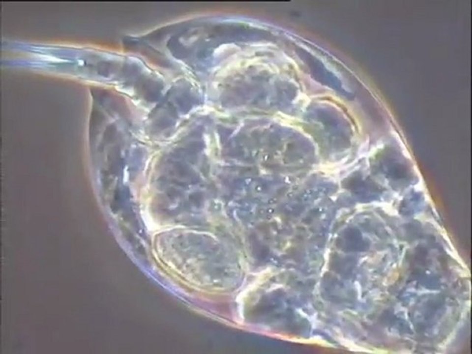 Examen d'une boue âgée d'un mois au microscope : détail des faunes