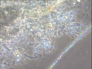 Examen de la boue contaminée des filtres EPI âgée d'une semaine : observation des faunes