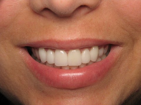 Dental search engine optimization by 5280Click Denver Online Marketing