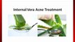 Permanently Cure Your Acne Breakouts Using the Aloe Vera Acne Treatment