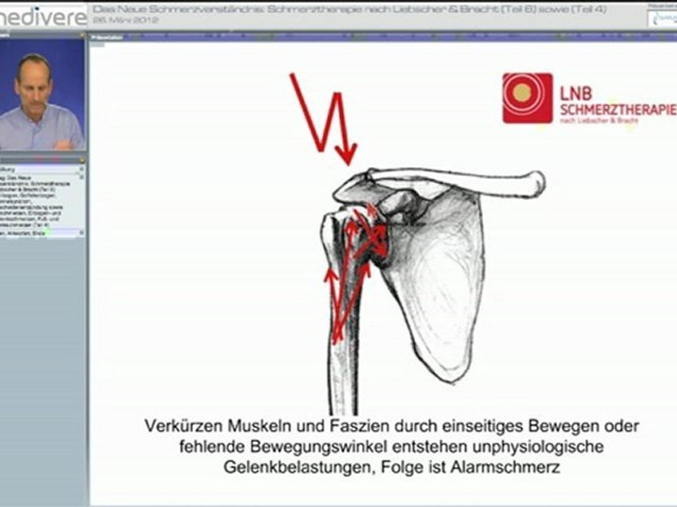 LNB bei Schulter-, Arm- und Handschmerzen - Teil 1