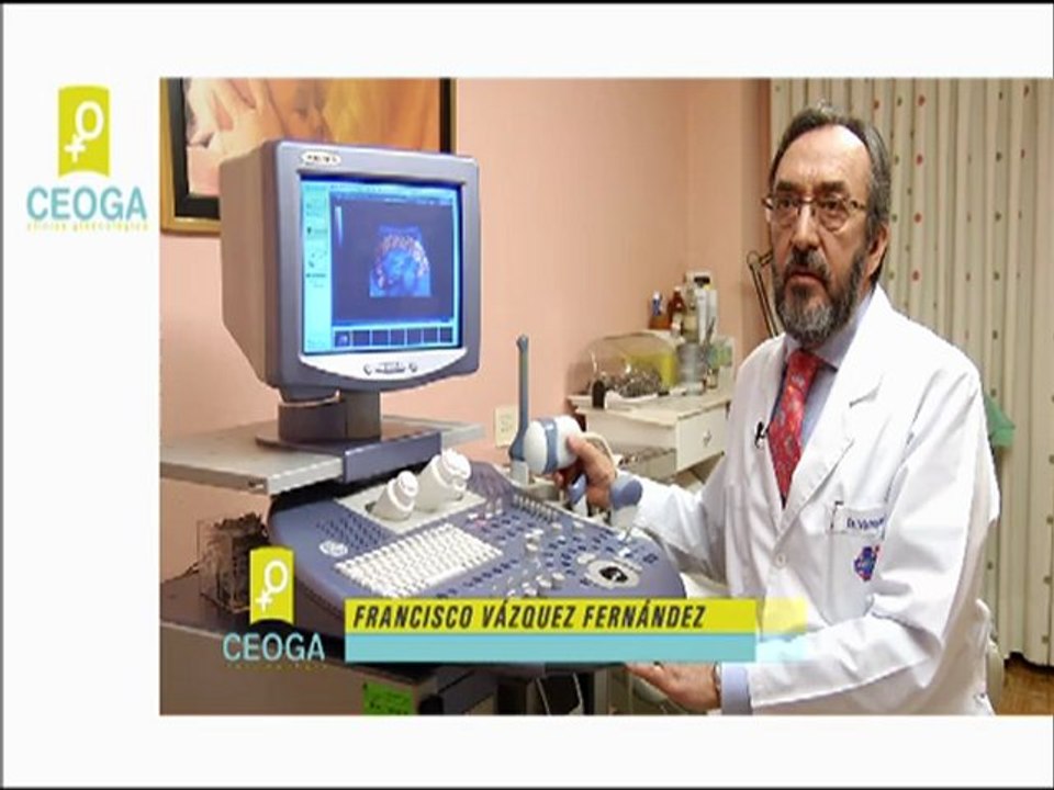 Ecografia 4D Lugo