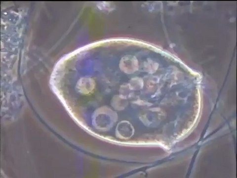 Etude de boues d’Achères III présentant des mousses blanches (côté prétraitement)