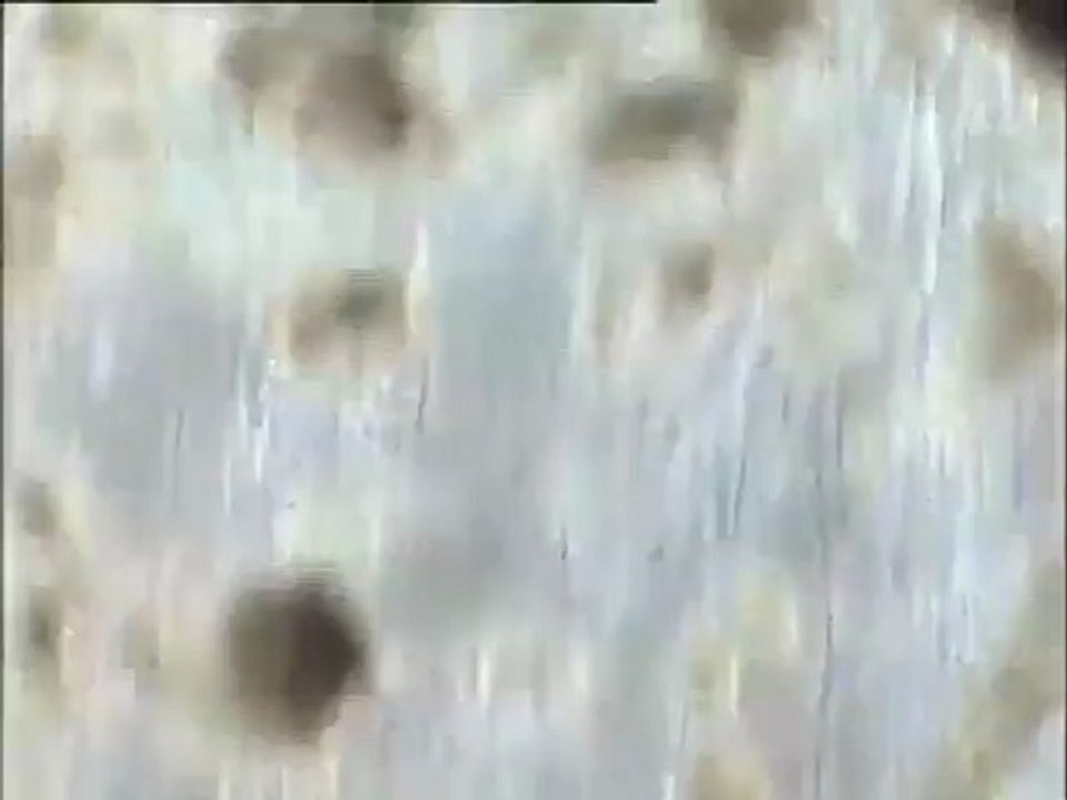 Examen de boues filamenteuses d'Achères  IV puis d'Achères III au microscope (bassin combiné)