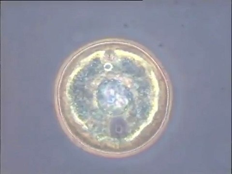 Thécamibes Arcella sur fibres de cellulose (échantillon ERM de la papeterie de la ville de Thiers) et prédation entre amibes