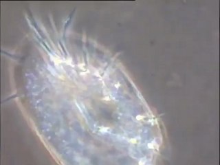 Micro-organismes à la surface d'un floc : cilié prédateur et rotifère à très fort grossissement