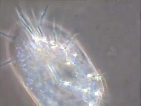 Micro-organismes à la surface d'un floc : cilié prédateur et rotifère à très fort grossissement