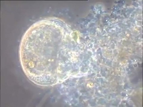 Prédation d’une Arcella par une autre amibe