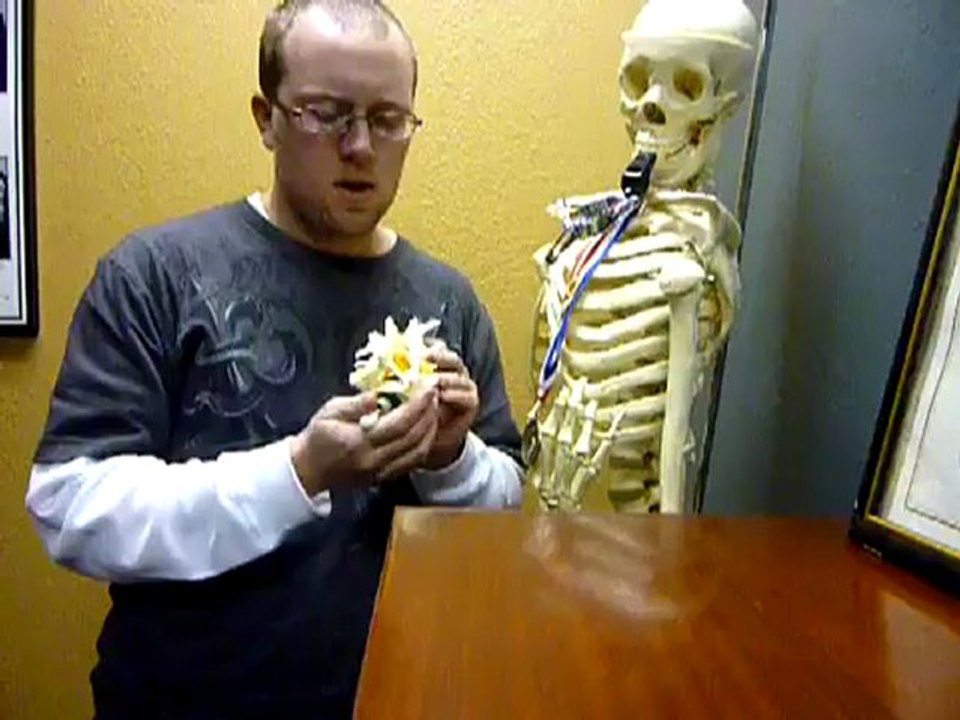 Subluxations Explained