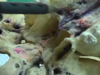 kafatası kemik-tkr-