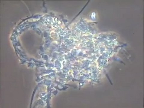 Examen d’une boue de lavage filamenteuse du Biofor (fort grossissement)