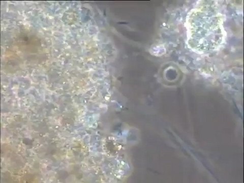 Examen de boues de lavage filamenteuses du bassin combiné