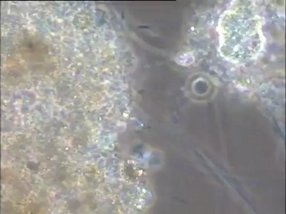 Examen de boues de lavage filamenteuses du bassin combiné