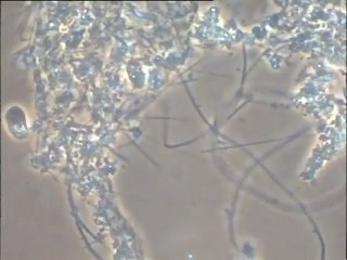 Examen d’une préparation de fibres de cellulose conservées dans l’urine et ensemencées avec une boue activée